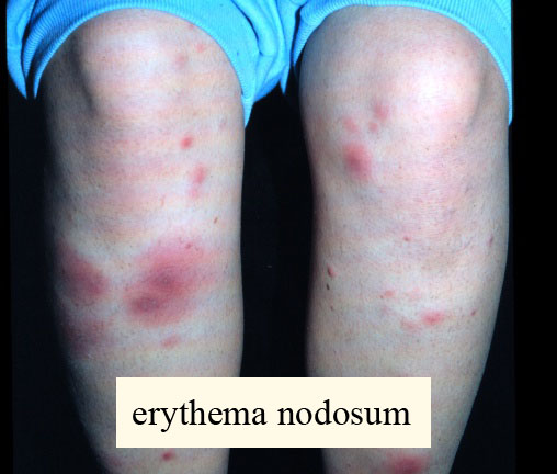 Enodosum2_msolata